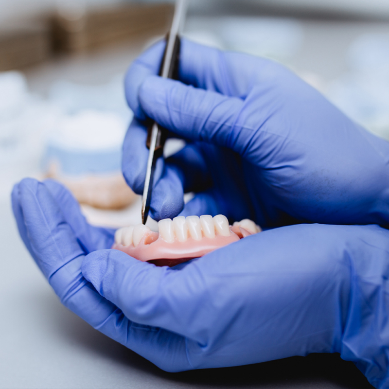 La Procédure d'Implant Dentaire All-on-4 en Turquie : Un Nouveau Sourire chez İnci Diş